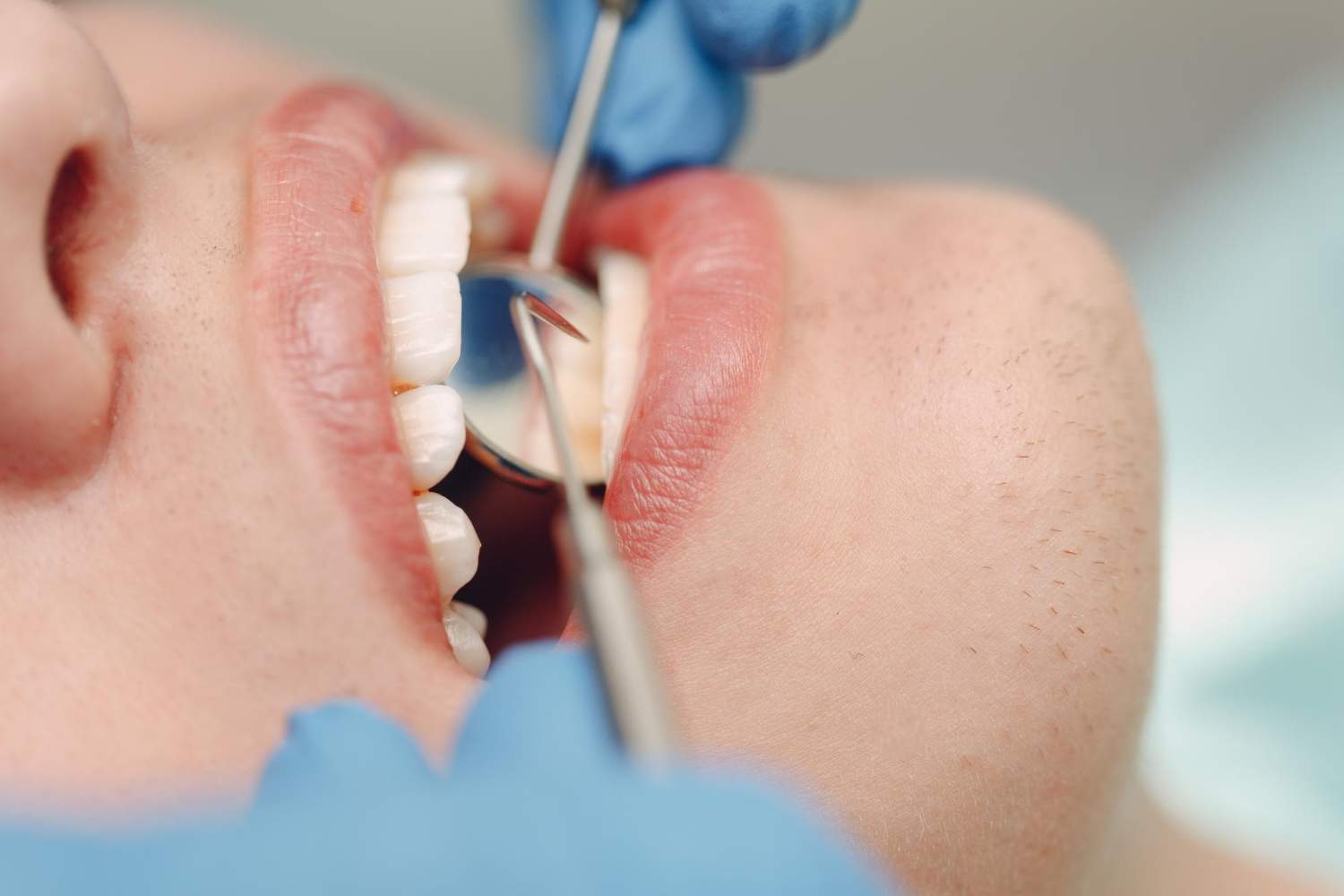 Periodoncia: síntomas, tratamientos y cómo prevenir las enfermedades de las encías