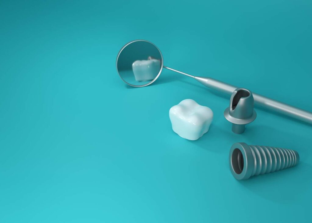 Implante dental de titanio junto a su pilar y su corona