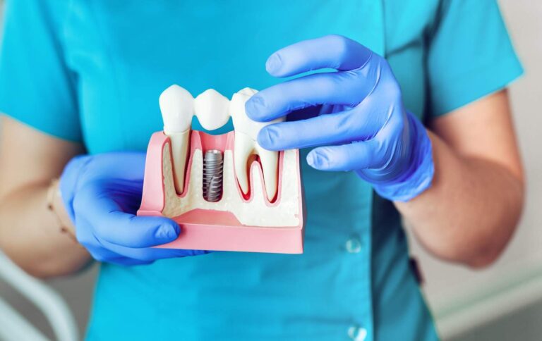 Dentista sujetando un modelo de implante dental con su corona